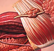 Sialendoscopy Sialendoscopy